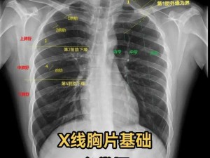 胸片全体曝光;胸片全体曝光这些惊人的秘密你绝对想不到