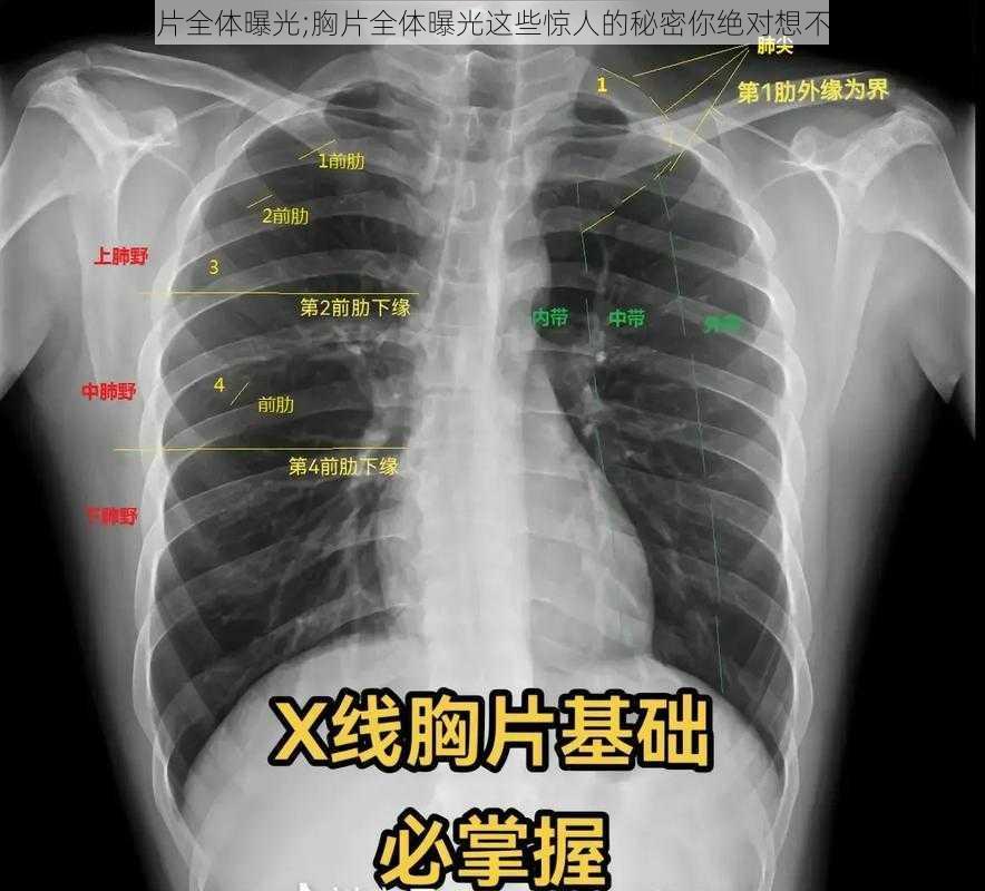 胸片全体曝光;胸片全体曝光这些惊人的秘密你绝对想不到